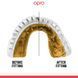 Капа OPRO GEN5 Gold Braces White Gold, Білий